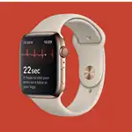 Smart Watches